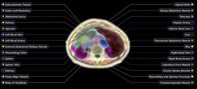 Midjourney выходит в медицину со сканером тела быстрее MRI