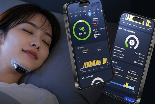 Sleep Flow NEO крепится под подбородком и подавляет храп электрической стимуляцией
